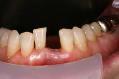 IMG_1578.JPGのサムネール画像のサムネール画像