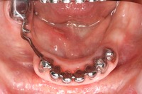 IMG_1656.JPGのサムネール画像