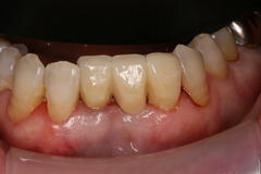 IMG_1723.JPGのサムネール画像のサムネール画像