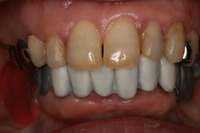 IMG_1767.JPGのサムネール画像のサムネール画像