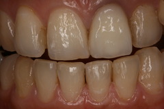 IMG_1794.JPGのサムネール画像