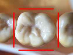 一日に何回歯磨きしますか?