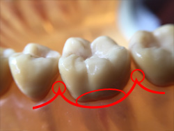 歯のどこを狙って磨いていますか?