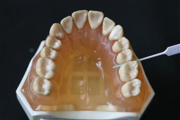 歯を次第に失っていくのをストップするには