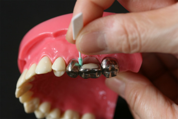 歯を次第に失っていくのをストップするには