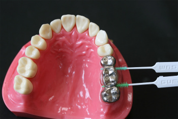 歯を次第に失っていくのをストップするには