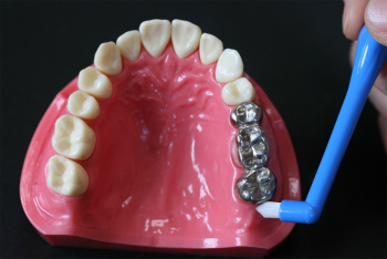 歯を次第に失っていくのをストップするには