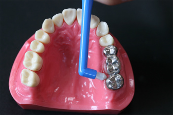 歯を次第に失っていくのをストップするには