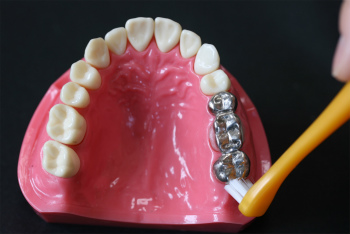 歯を次第に失っていくのをストップするには