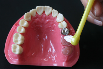 歯を次第に失っていくのをストップするには