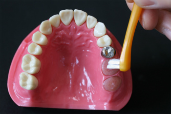歯を次第に失っていくのをストップするには