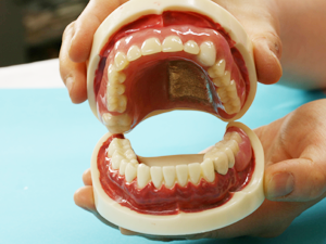 入れ歯