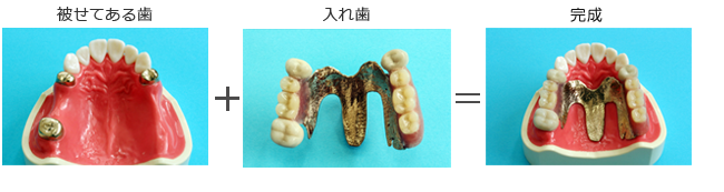 コーヌステレスコープ
