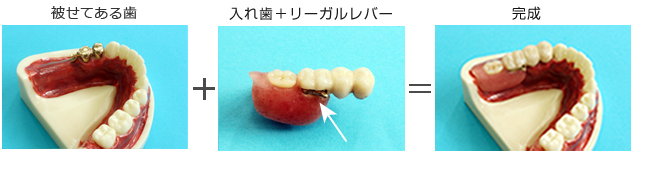 リーゲルテレスコープ