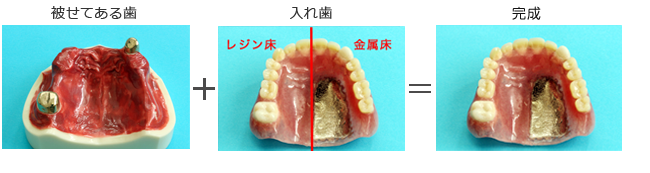 レジリエンステレスコープ